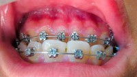 CLINICA DE IMPLANTES Y ESTETICA DENTAL SAN MARTIN DE PORRES
